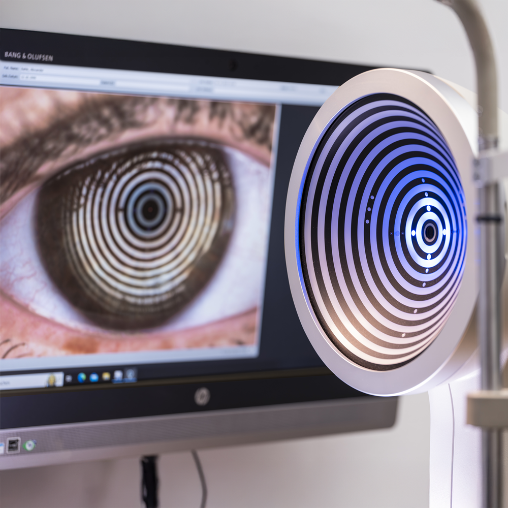 Tränenflüssigkeitmessung im Optiker Gutekunst Feuchtwangen